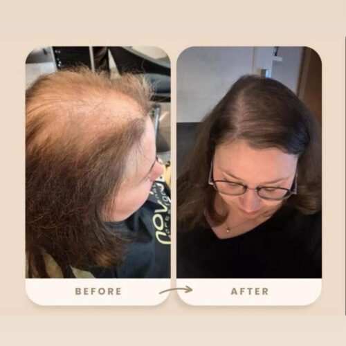 Aurodhea anti hairloss shampoo buy online grezni lv