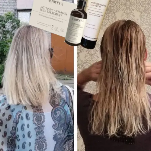 Clients results anti hair loss shampoo autrodhea 2