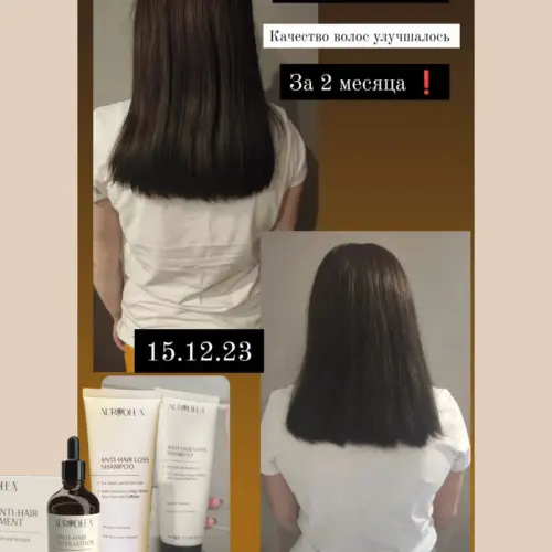 Clients results anti hair loss shampoo autrodhea 2