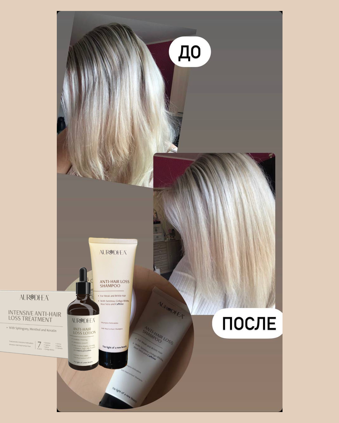 Clients results anti hair loss shampoo autrodhea 2