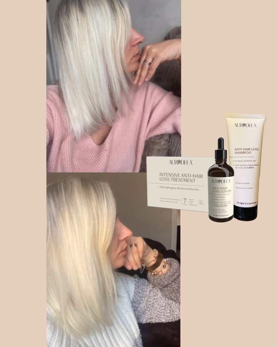 Clients results anti hair loss shampoo autrodhea 2