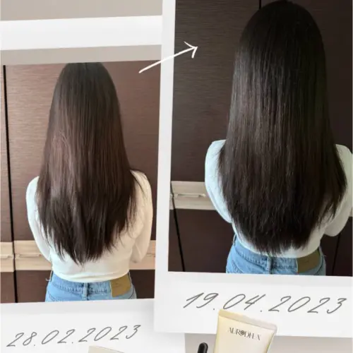 Clients results anti hair loss shampoo autrodhea 2