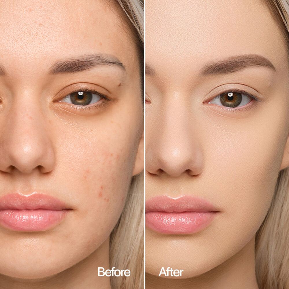 Компактна тональна основа MoniAmori з SPF30 - Meringa MM005 - Зображення 5